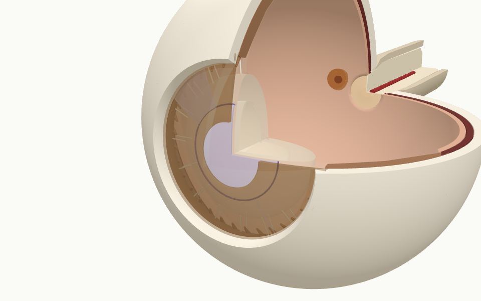 Modelo 3D del ojo mostrando una lente fáquica ICL detrás del iris