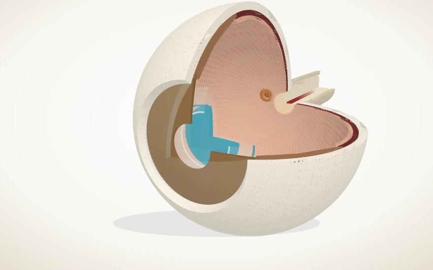 Vista del modelo 3D con una lente intraocular implantada dentro del ojo